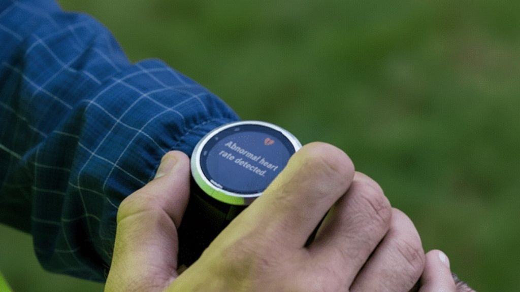 Garmin abnormal heart rate