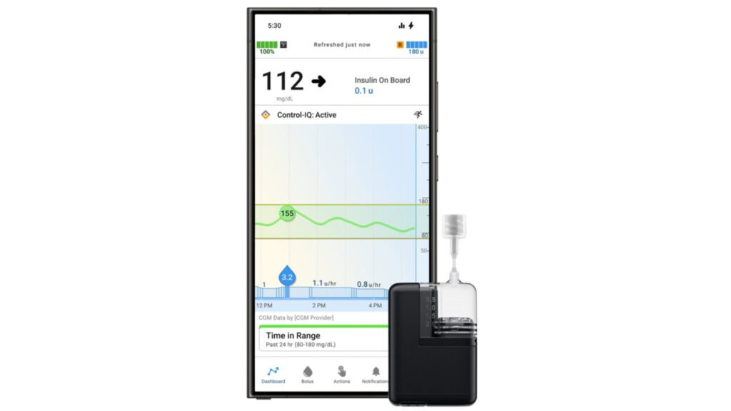 Tandem Mobi Insulin Pump Now Compatible With Android Phones in the US Tandem Mobi Insulin Pump Now Compatible With Android Phones in the US