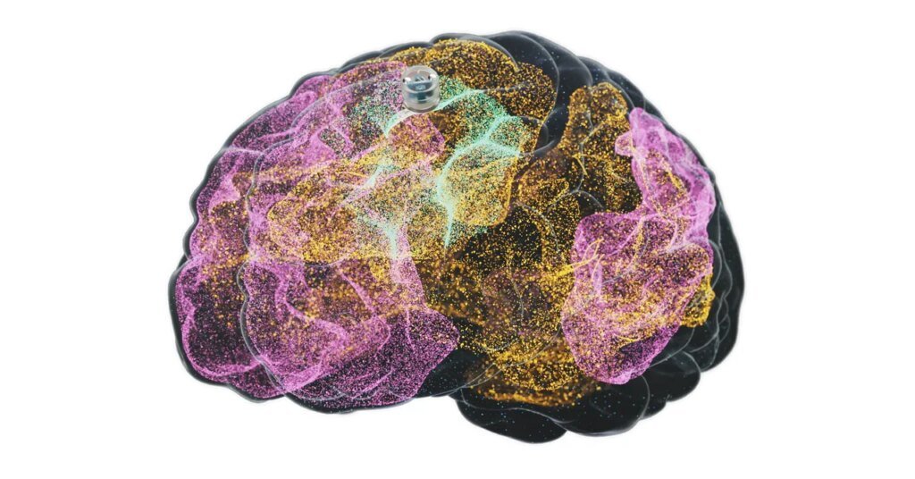 A Brain Implant for Depression Is About to Be Tested in Humans