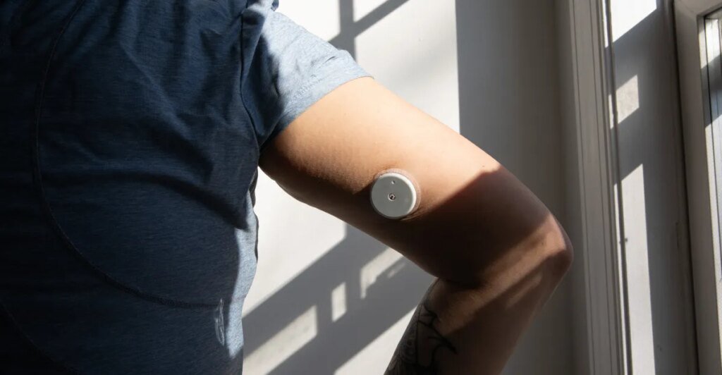 Continuous glucose monitoring made me continuously crazy