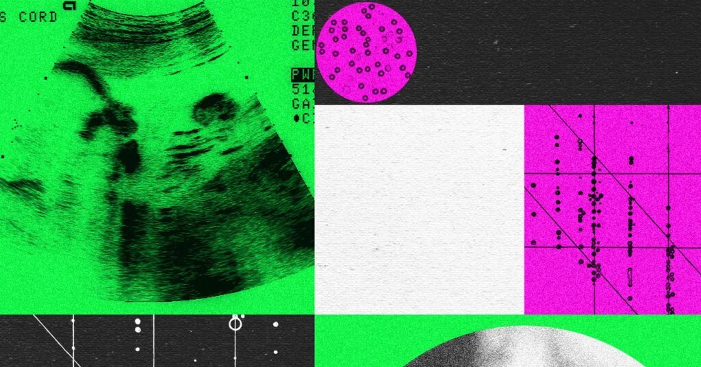 Designer Baby Companies Are in Turmoil